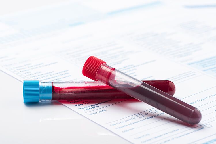 Advanced Diagnostic Testing